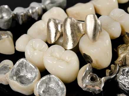 Dental Alloys Market Research Provides Insights on Regional Growth Trends Across North America, Asia-Pacific and Europe