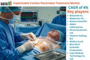Implantable Cardiac Pacemaker Treatment Market Set to Surge: Innovative Treatments and Growth Trends 2025